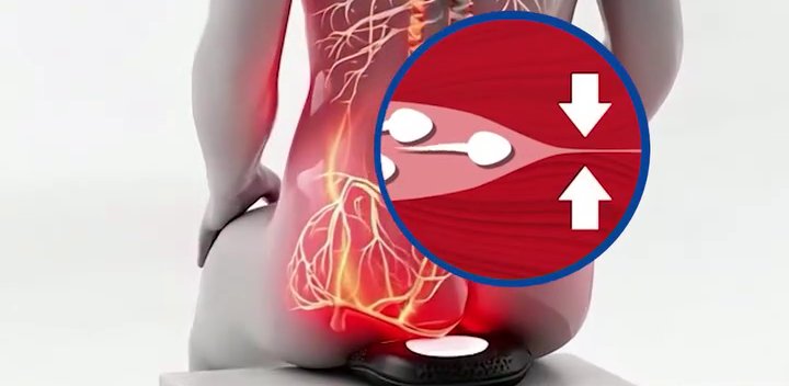 High control of the pelvic floor muscles